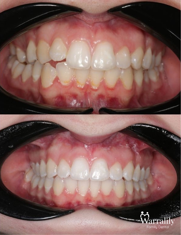 Smile transformation_w logo_1