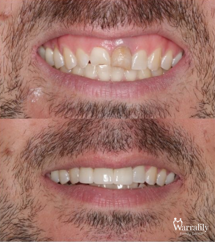 Smile transformation_w logo_2