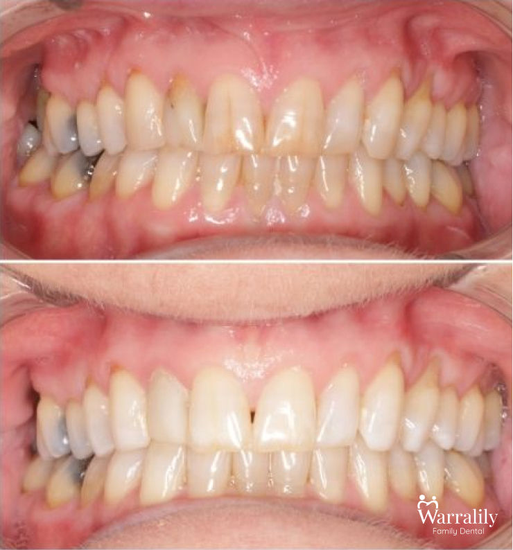 Smile transformation_w logo_3