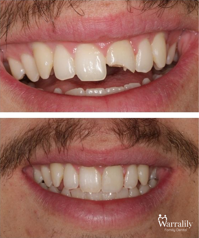 Smile transformation_w logo_4