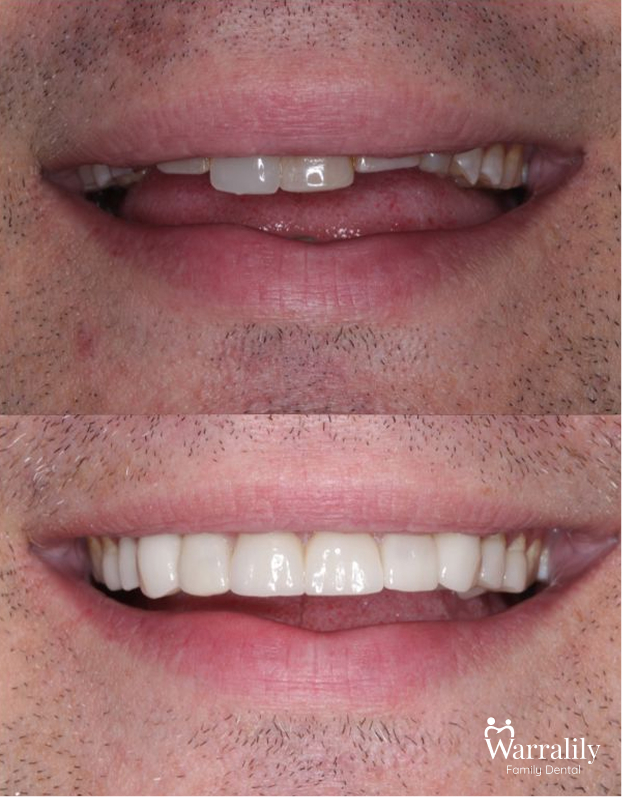 Smile transformation_w logo_5
