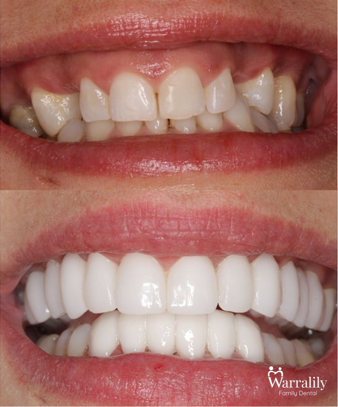 Smile transformation_w logo_6