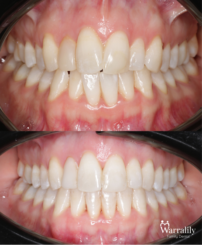Smile transformation_w logo_7