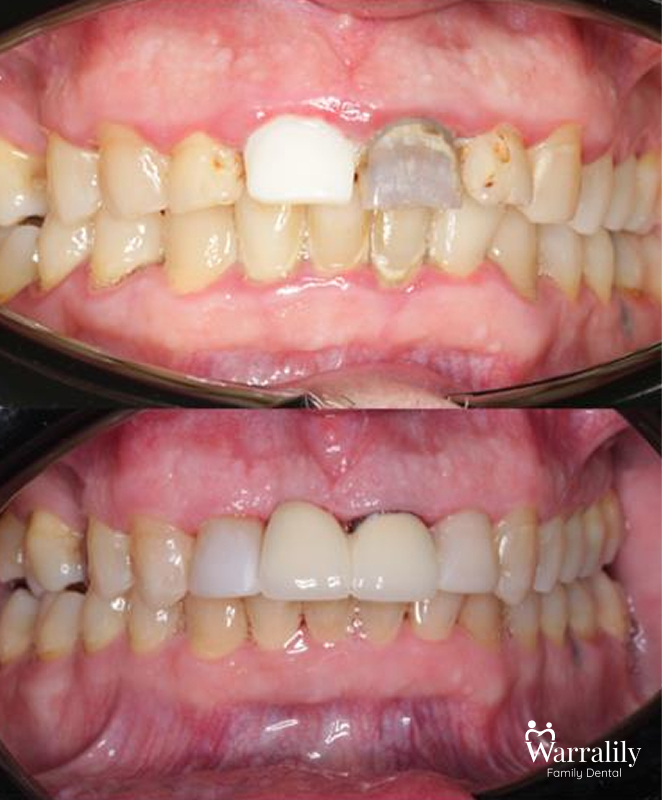 Smile transformation_w logo_8