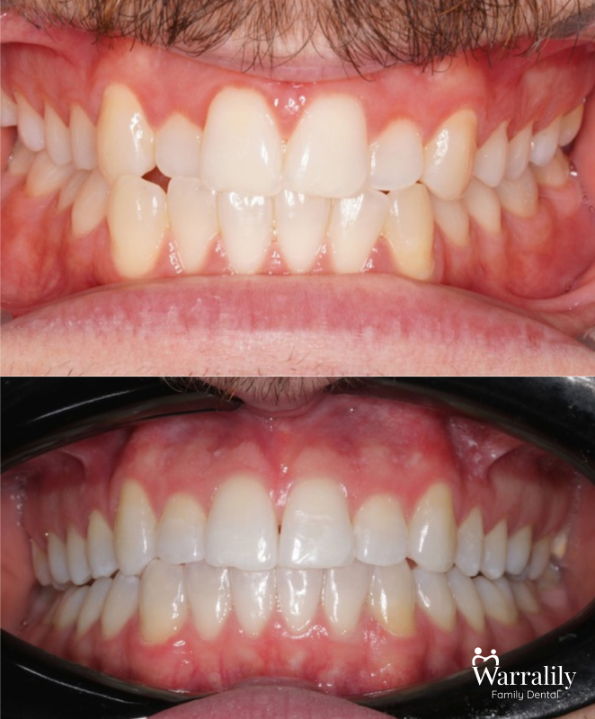 Smile transformation_w logo_9